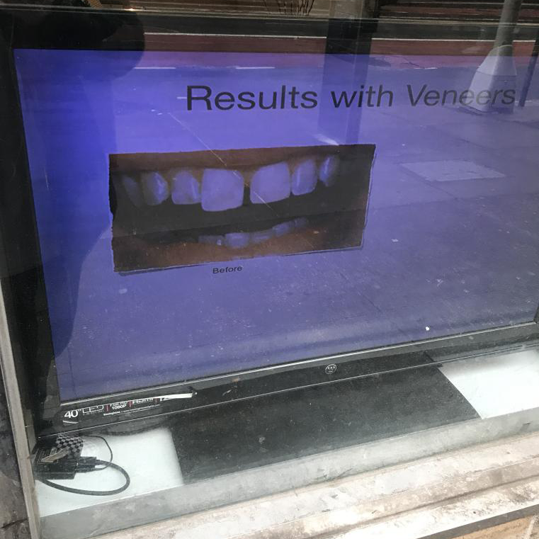 a tv screen behind a store front that shows teeth and says results of veneers